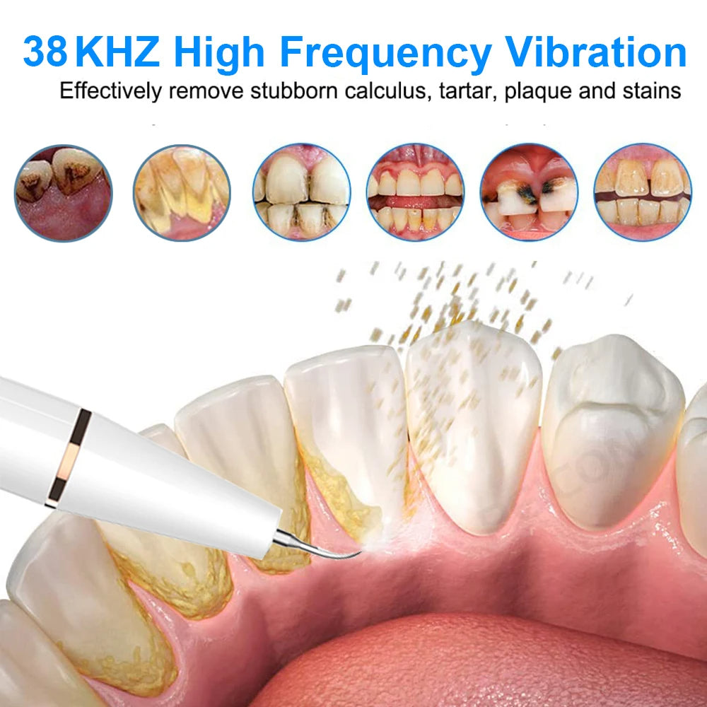 the best Ultrasonic Dental Teeth Plaque Remover & Cleaner
